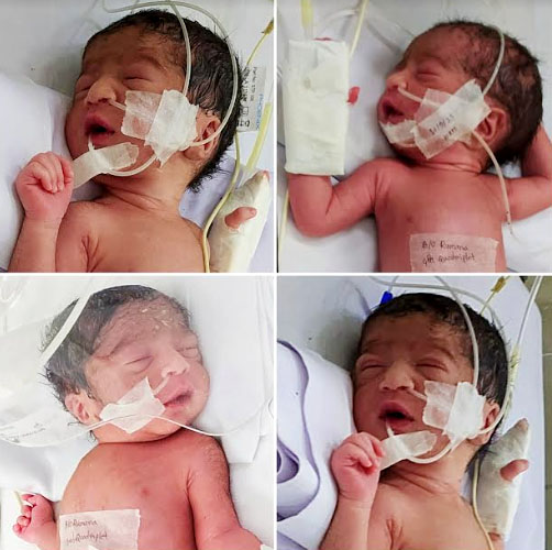 মানিকগঞ্জ: একসাথে জন্ম নেওয়া চার শিশু।-ছবি মুক্ত প্রভাত