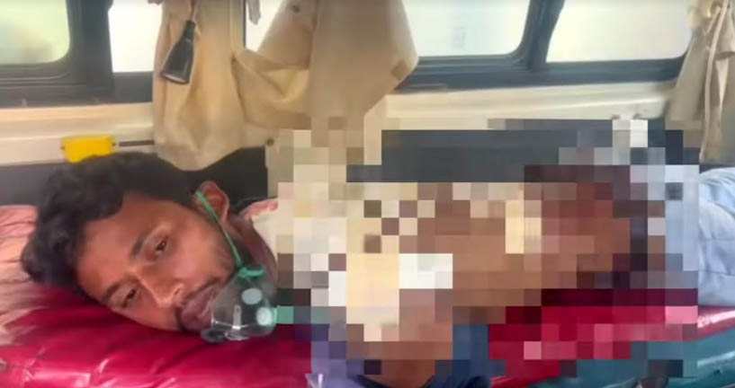 নাটোরে রাজনৈতিক দ্বন্দ্বের জেরে এবার যুবলীগকর্মীকে কুপিয়ে যখম 