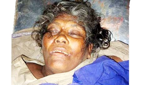 সাঁথিয়ায় সড়ক দুর্ঘটনায় অজ্ঞাত নারী নিহত