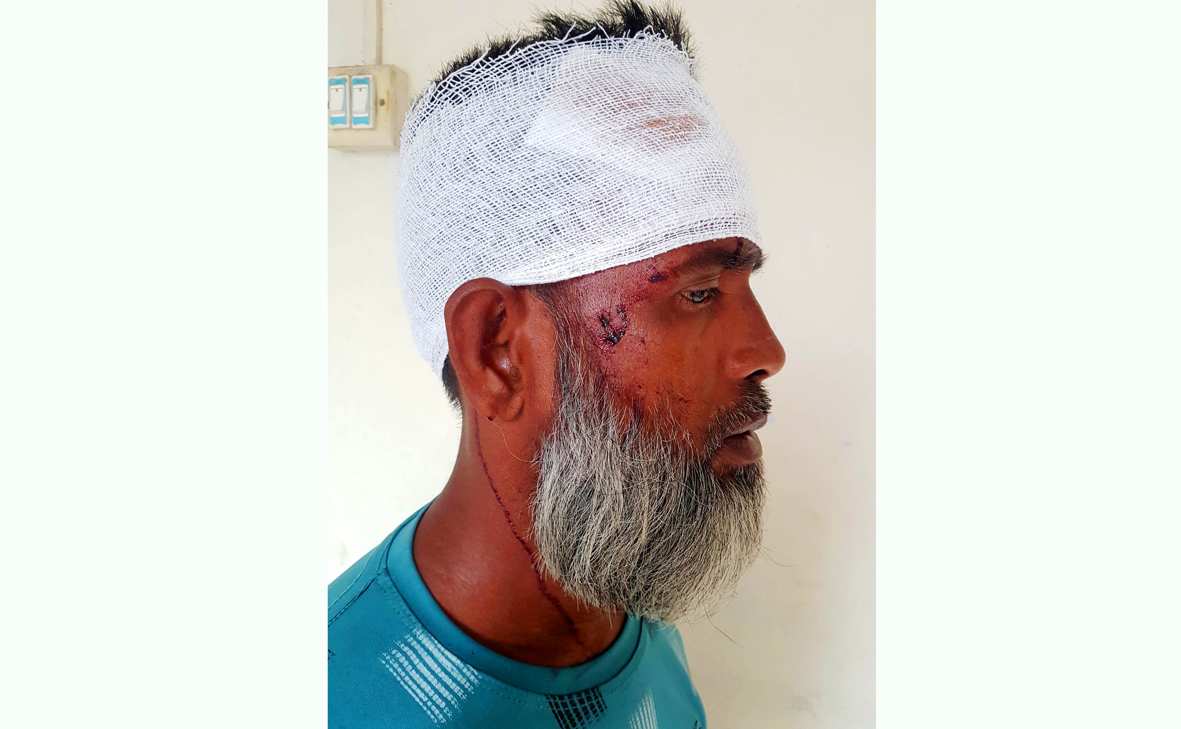 ধুনটে কৃষককে কুপিয়ে জখম