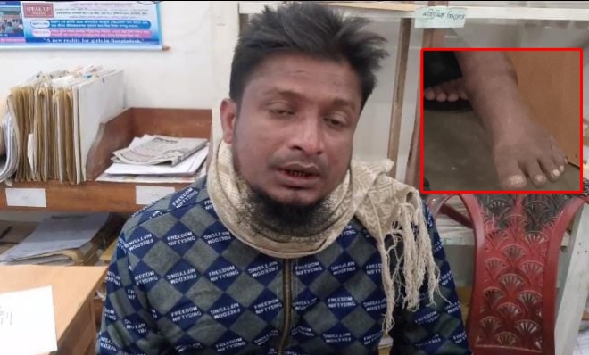 গুলিবিদ্ধ রিক্সা চালক তালার সোলাইমান চান সরকারি সহযোগিতা
