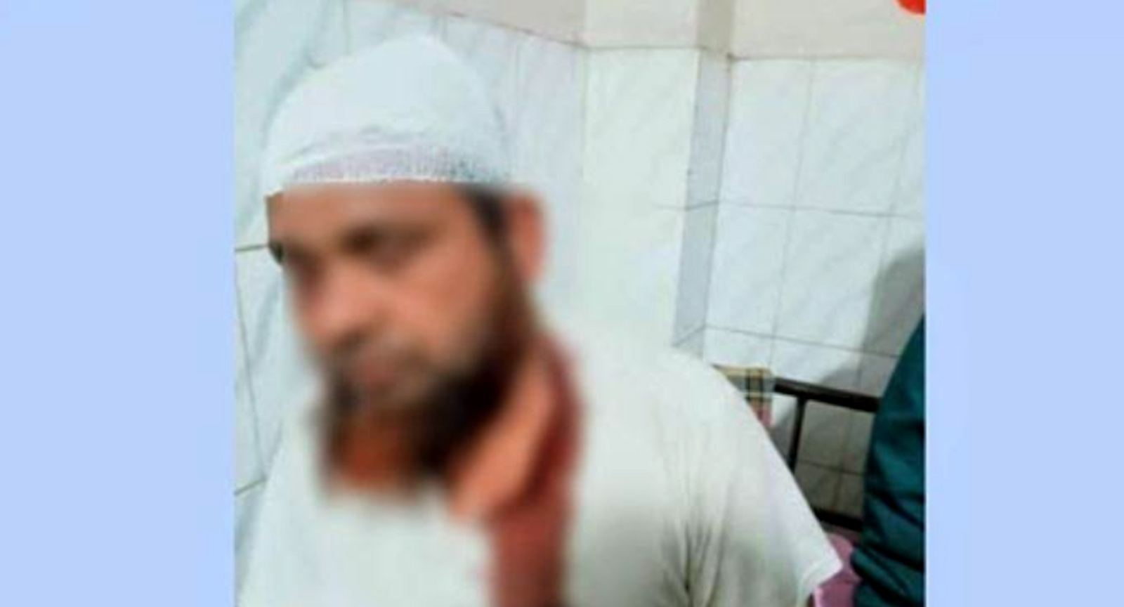 বাগমারায় প্রতিপক্ষের হামলায় বিএনপি আহত