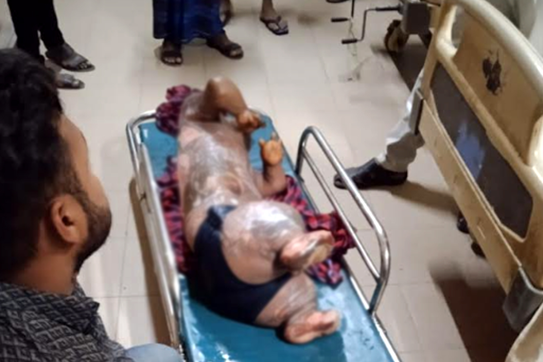 নোয়াখালীতে অটোরিকশার সিলিন্ডার বিস্ফোরণে পাঁচ শিশুসহ আহত ৬