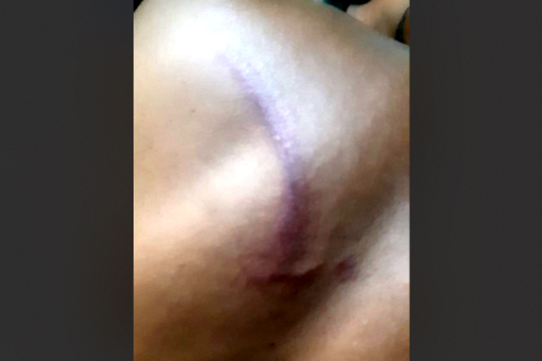সরকারি জমির মাটি কাটায় বাধা, গ্রাম পুলিশের পরিবারে হামলা