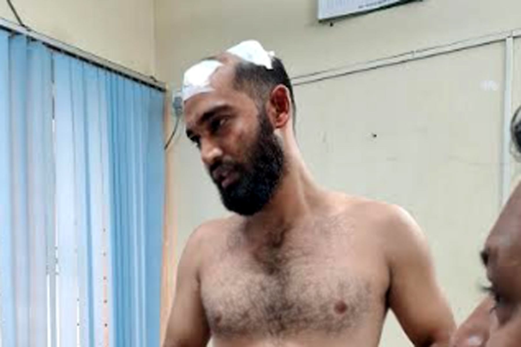 কোম্পানীগঞ্জে বাসে বেশি ভাড়া নেওয়ার প্রতিবাদ করায় মাথা ফাটালো যাত্রীর