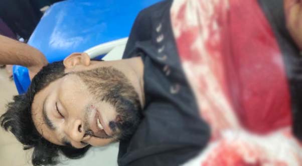 নোয়াখালীতে চাঁদা না পেয়ে প্রবাসীর হাতের কবজি কাটল সন্ত্রাসীরা