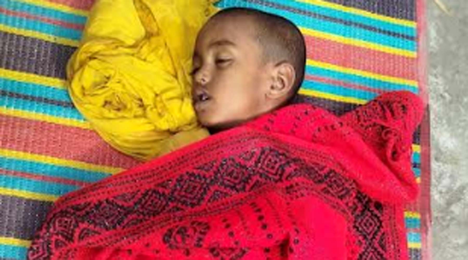 গলায় বেলুন আটকে শিশুর মৃত্যু