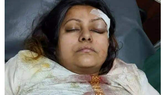 সড়ক দূর্ঘটনায় গোবিপ্রবির সহকারী অধ্যাপক আহত