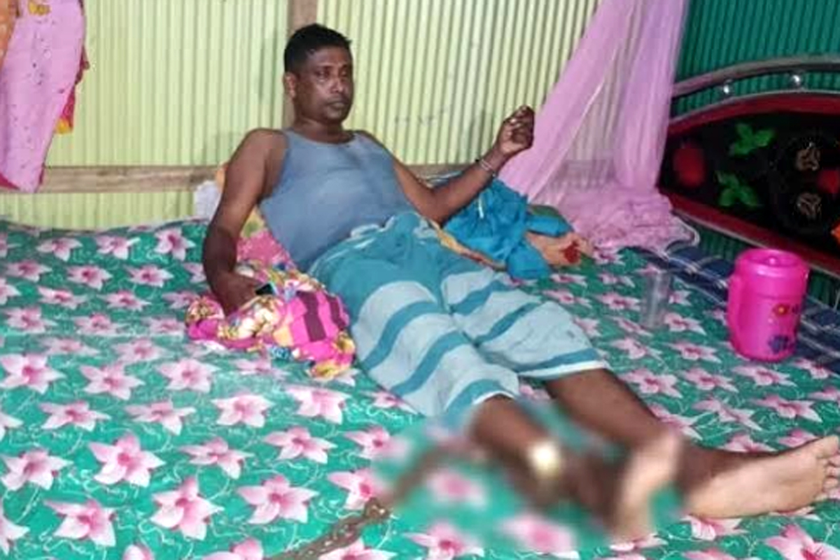 নোয়াখালীতে টাকার জন্য অটোরিকশাচালককে শিকলে বেঁধে নির্যাতন