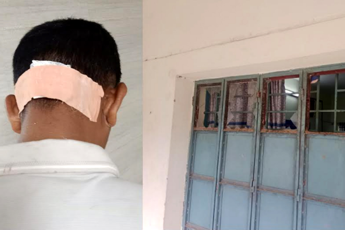 বিদ্যালয়ে ডিও লেটার জমা ঘিরে উত্তেজনা, ছুরিকাঘাতে যুবদল কর্মী আহত