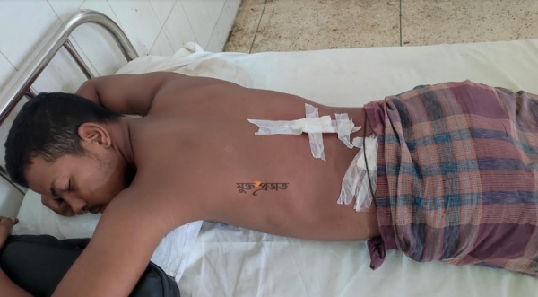 তিতাসে আম পারাকে কেন্দ্র করে ছুরিকাঘাতে যুবক আহত 
