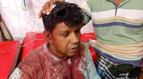 সিংড়ায় আওয়ামী লীগের এক পক্ষের হামলায় অপর পক্ষের ৬ জন আহত
